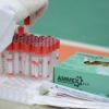 Коронавируст халдварыг тандах, илрүүлэх шинжилгээнд 71950 иргэнийг хамруулав