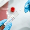 Өнгөрсөн хоногт коронавируст халдварын 95 тохиолдол шинээр батлагджээ