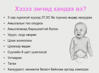 Томуугийн үед олон хоног өндөр халуурч, маш их ханиалгана